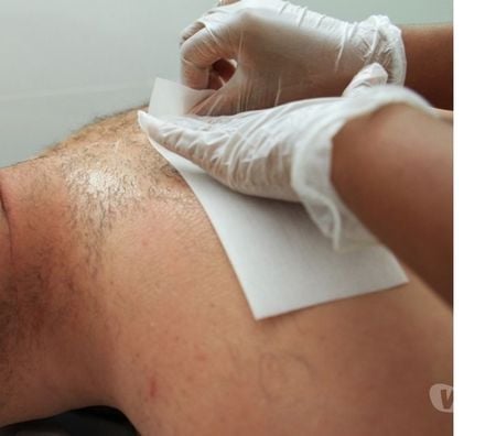 Bem-Estar - Saúde - Beleza Porto Alegre RS Porto Alegre Sul - Fotos para Depilação masculina em Porto Alegre