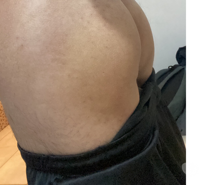 Encontros Casuais - Fotos para Faço boquete no pau de hétero casado (bebo seu leite)