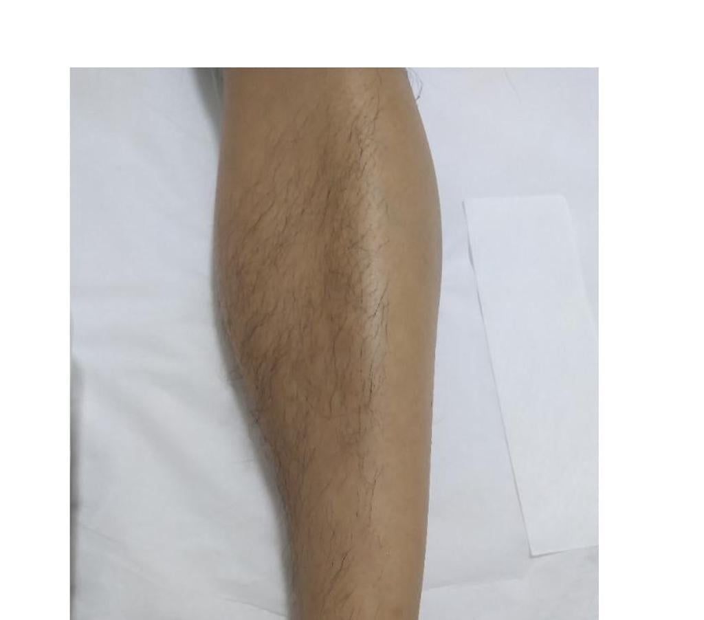 Bem-Estar - Saúde - Beleza Sao Paulo SP Vila Mariana - Fotos para Massagem é Depilação.