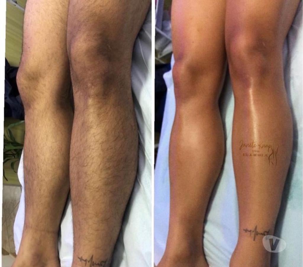 Bem-Estar - Saúde - Beleza Rio de Janeiro RJ Centro - Fotos para Massagem Relaxante e Terapêutica