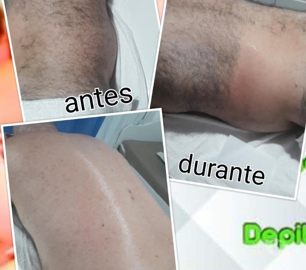 Bem-Estar - Saúde - Beleza Sao Jose SC - Fotos para Massagem relaxante e depilação com a Fernanda gringa