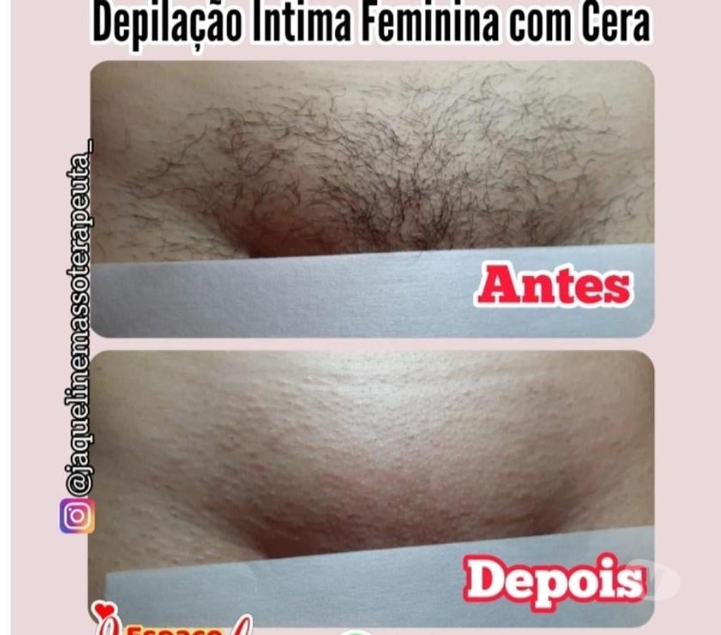 Bem-Estar - Saúde - Beleza Sao Paulo SP República - images_alt_text MASSOTERAPIA E DEPILAÇÃO FEMININO E MASCULINO