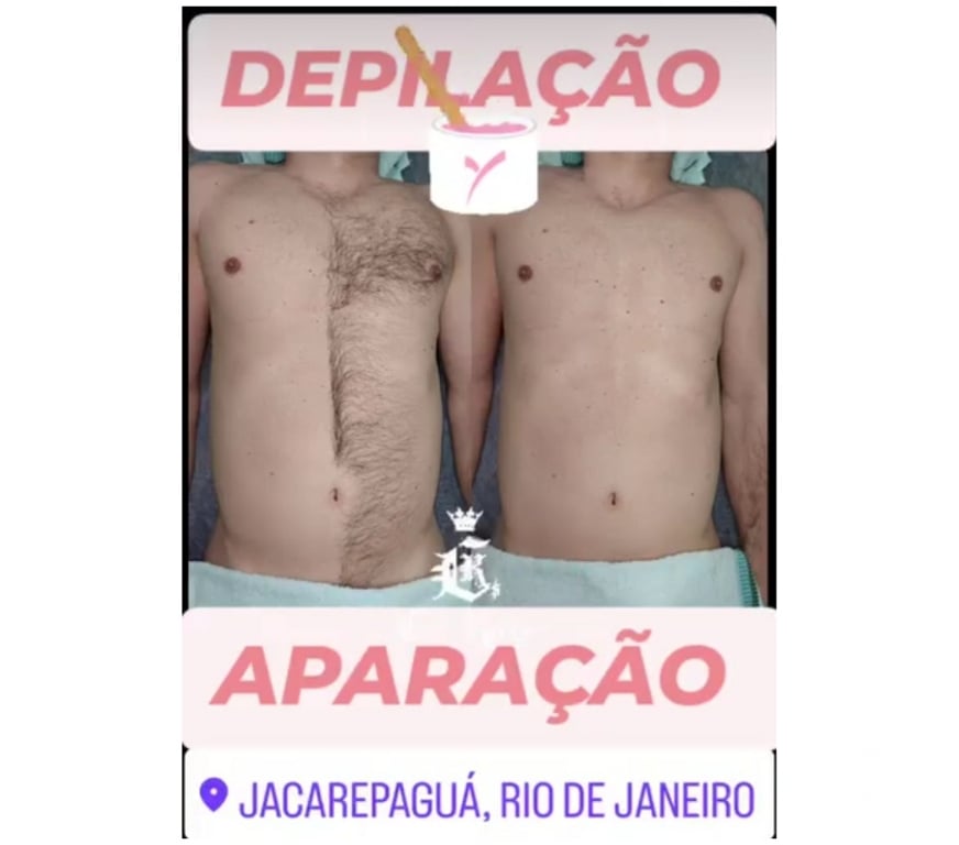 Bem-Estar - Saúde - Beleza Rio de Janeiro RJ Jacarepaguá - images_alt_text MASSAGEM E DEPILAÇÃO TAQUARA