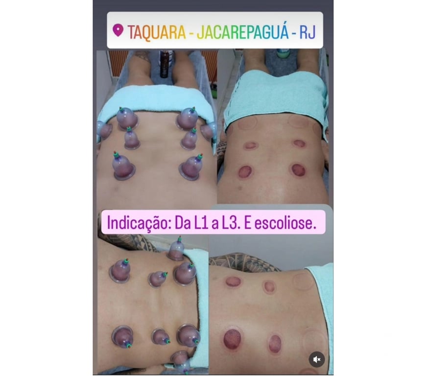 Bem-Estar - Saúde - Beleza Rio de Janeiro RJ Jacarepaguá - images_alt_text MASSAGEM E DEPILAÇÃO TAQUARA