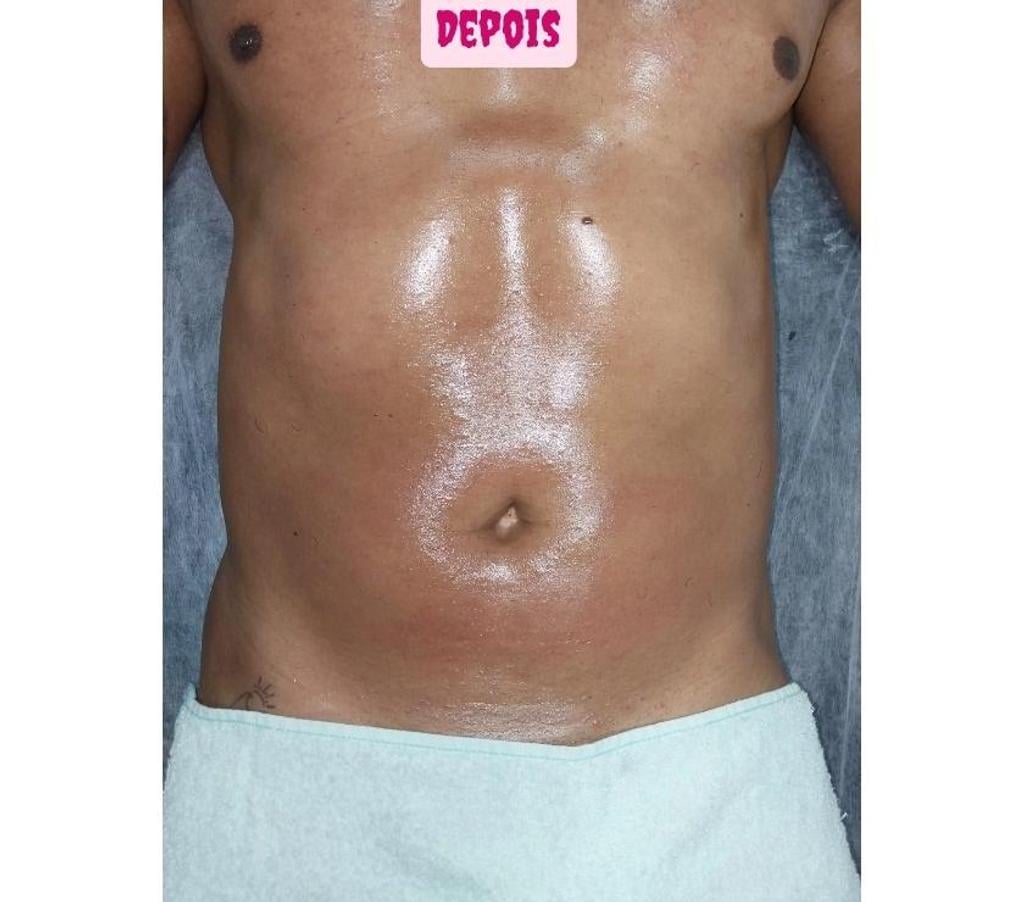 Bem-Estar - Saúde - Beleza Rio de Janeiro RJ Jacarepaguá - images_alt_text MASSAGEM E DEPILAÇÃO TAQUARA