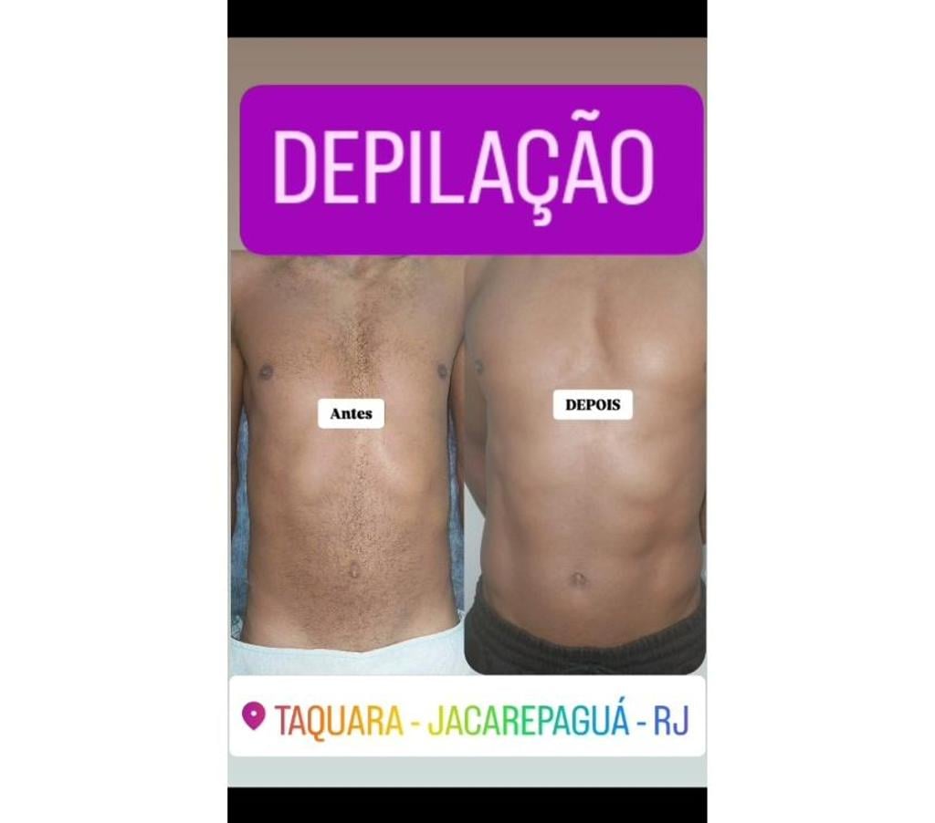 Bem-Estar - Saúde - Beleza Rio de Janeiro RJ Jacarepaguá - images_alt_text MASSAGEM E DEPILAÇÃO TAQUARA