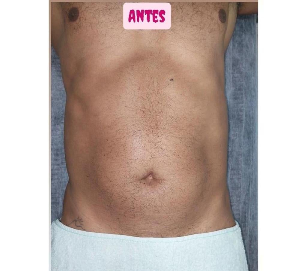 Bem-Estar - Saúde - Beleza Rio de Janeiro RJ Jacarepaguá - images_alt_text MASSAGEM E DEPILAÇÃO TAQUARA