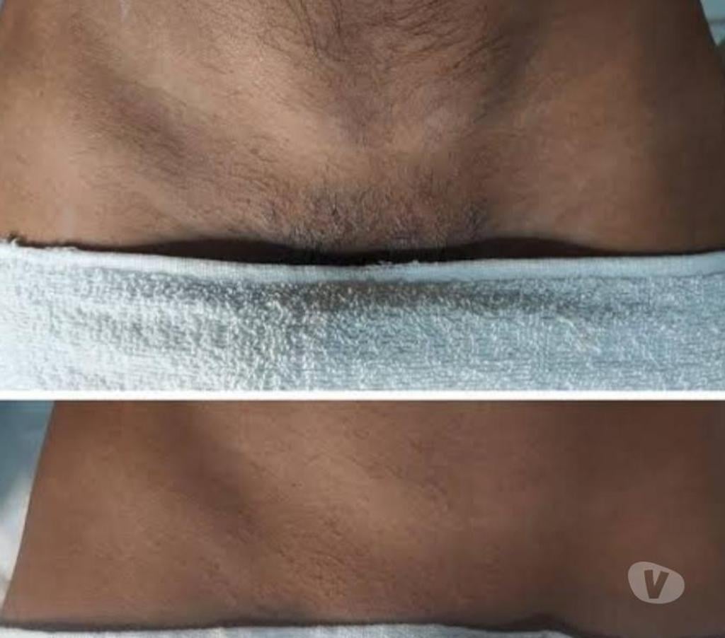 Bem-Estar - Saúde - Beleza Curitiba PR Santa Felicidade - images_alt_text Depilação exclusiva masculina feita por homem