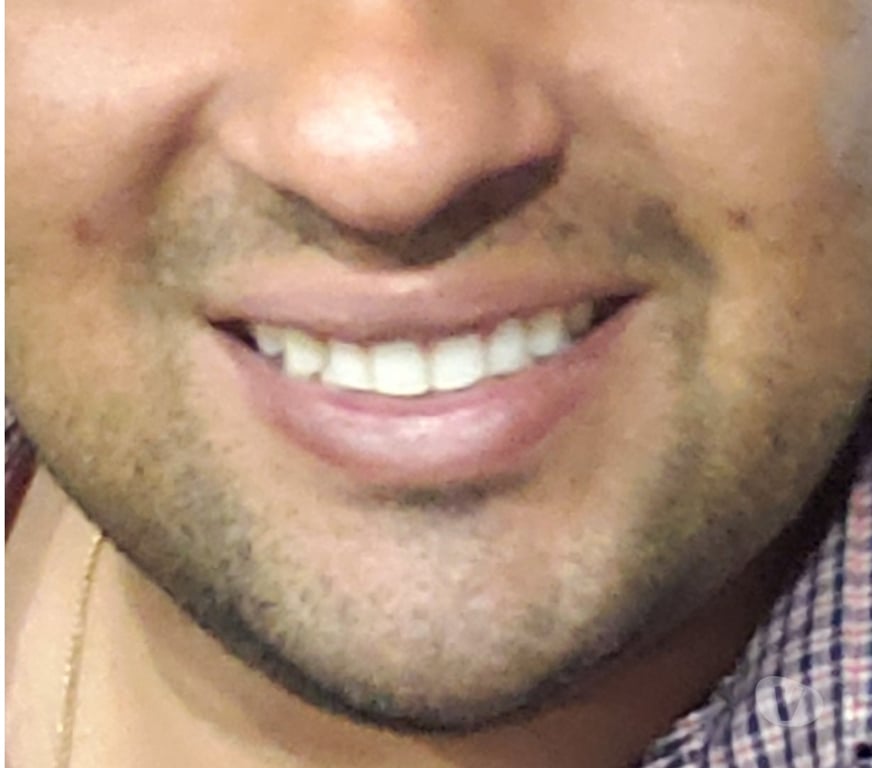 Encontros Casuais Caruaru PE - Fotos para Procuro por você mulher e casais.