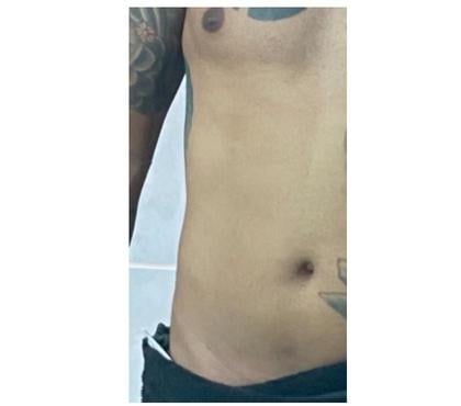 Encontros Casuais - Fotos para Para casal e mulher