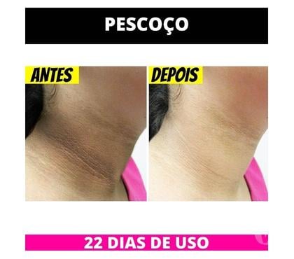 Cosméticos - Fotos para ✨Pele sem manchas com pagamento só na entrega!✨