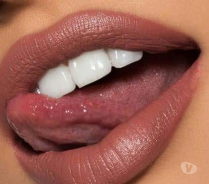 Acompanhantes - Fotos para Moranguinho Delicia