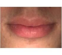 Virar depósito de leite