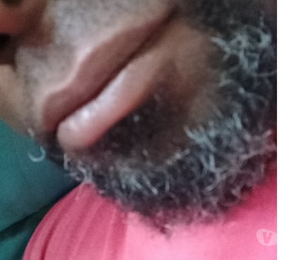 Encontros Casuais Nordeste Belo Horizonte MG - Fotos para Quero encontrar mulher com Vitiligo