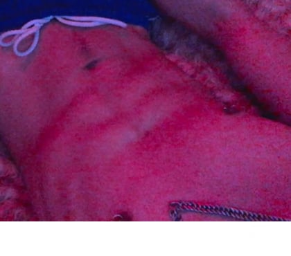 Encontros Casuais - Fotos para Apenas sexo , casadas e coroas “sigilo”