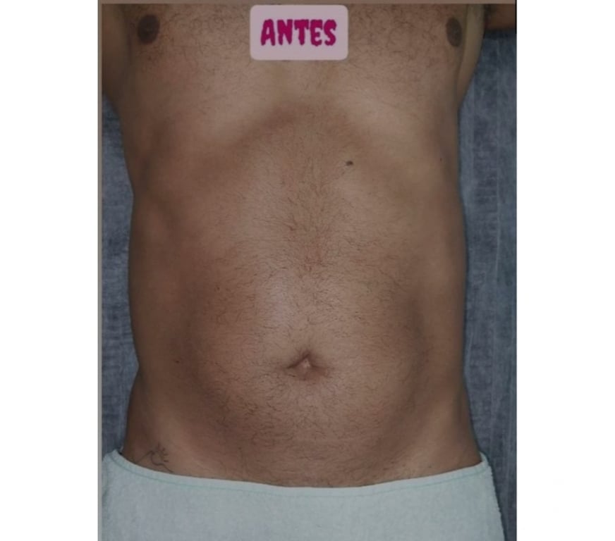 Acompanhantes masculinos Rio de Janeiro RJ Barra da Tijuca - images_alt_text MASSAGEM E DEPILAÇÃO