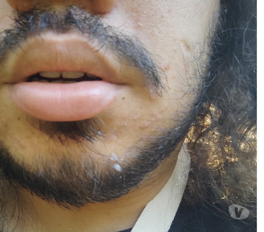 Homem procura Homem Campinas SP - Fotos para BARÃO GERALDO SEM LOCAL PASS