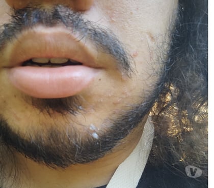 Homem procura Homem - Fotos para BARÃO GERALDO SEM LOCAL PASS