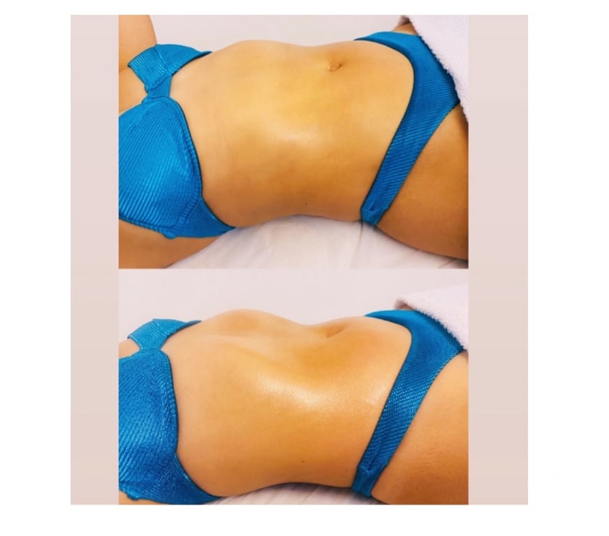 Bem-Estar - Saúde - Beleza Nova Iguacu RJ - Fotos para Massagem Relaxante – Bem-estar e Alívio do Estresse