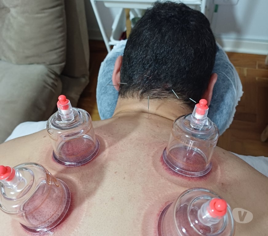 Bem-Estar - Saúde - Beleza Sao Paulo SP Consolação - Fotos para Quiropata, Acupunturista e Massoterapeuta