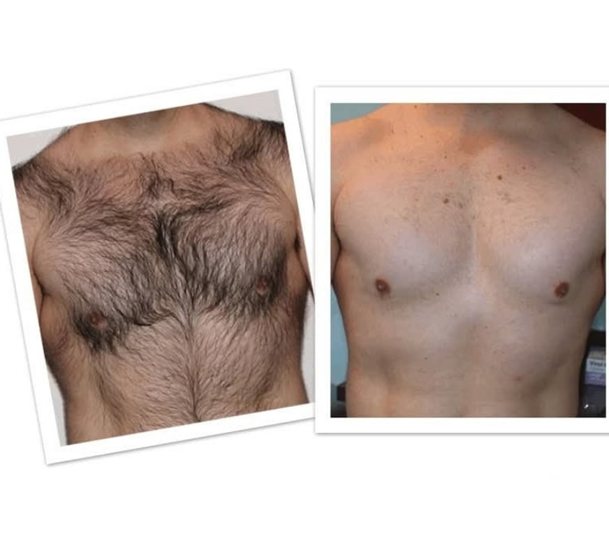 Bem-Estar - Saúde - Beleza Rio de Janeiro RJ Outros Bairros Rio de Janeiro RJ - Fotos para Massoterapia e Depilação Masculina e Feminina