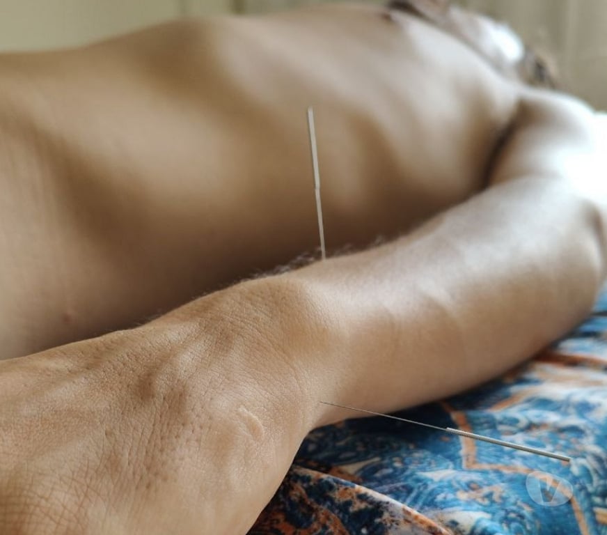 Bem-Estar - Saúde - Beleza Rio de Janeiro RJ Centro - Fotos para CHI Terapias Holisticas Acupuntura e Massoterapia