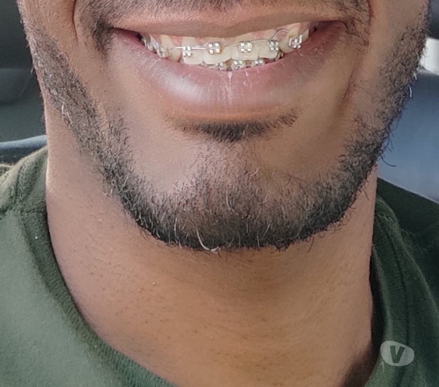 Encontros Casuais Salvador BA Itapuã - Fotos para Negão Comedor especialista senhoras