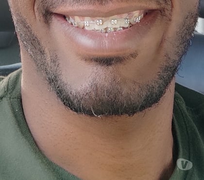 Encontros Sexuais Itapuã Salvador BA - Fotos para Negão Comedor especialista senhoras