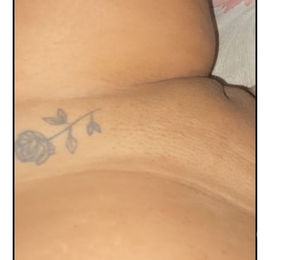 Acompanhantes - Fotos para Aqui vc vai ter muito prazer