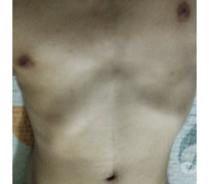 Encontros Casuais - Fotos para Procuro mulheres 18+ e novinhas para transar