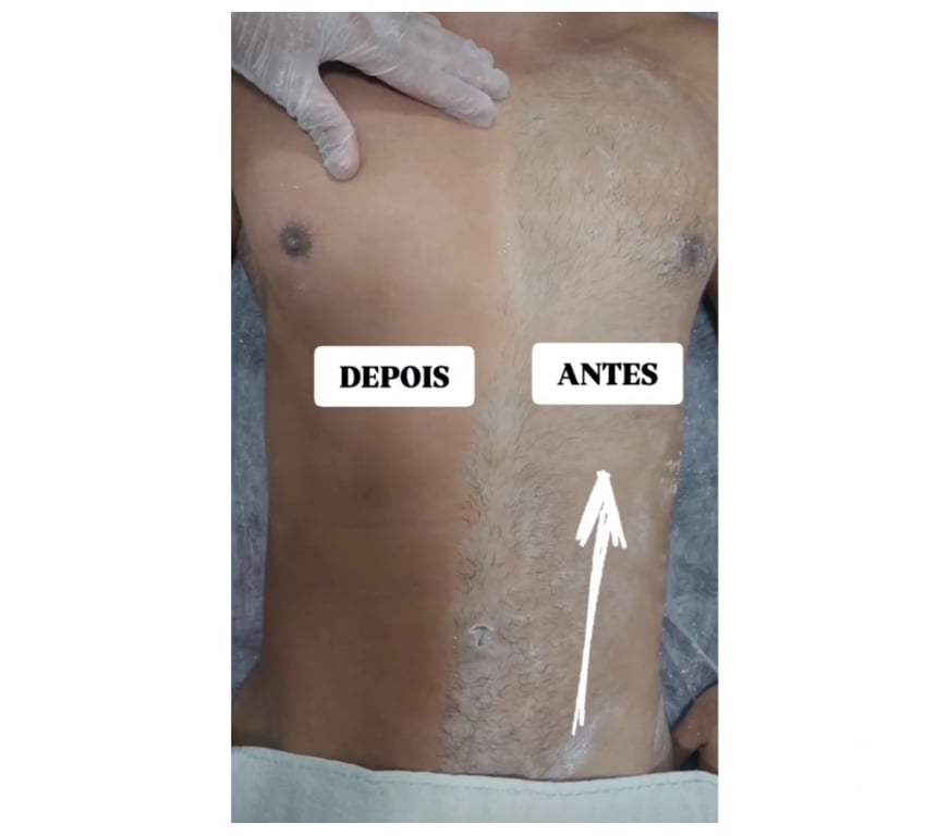 Bem-Estar - Saúde - Beleza Rio de Janeiro RJ Barra da Tijuca - Fotos para massagem e DEPILAÇÃO JACAREPAGUÁ