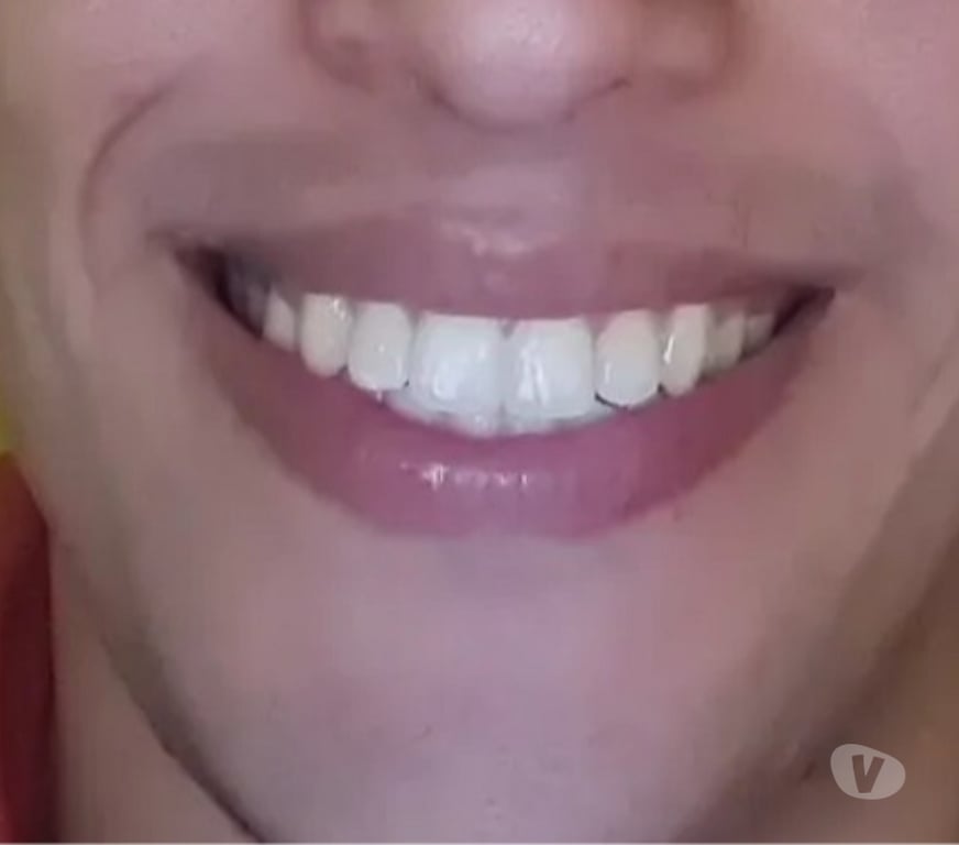 Acompanhantes masculinos Rio de Janeiro RJ Copacabana - Fotos para Massoterapeuta Copacabana posto 3