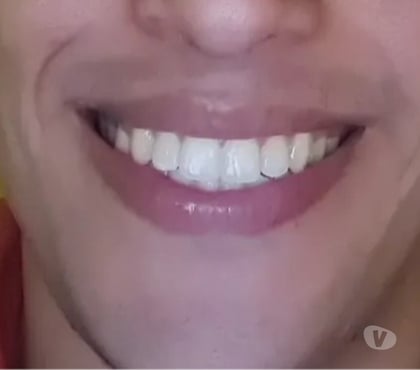 Garotos de programa Copacabana Rio de Janeiro RJ - Fotos para Massoterapeuta Copacabana posto 3