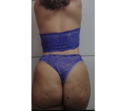 Encontros Casuais - Fotos para Casal quer dotado (LEIA)