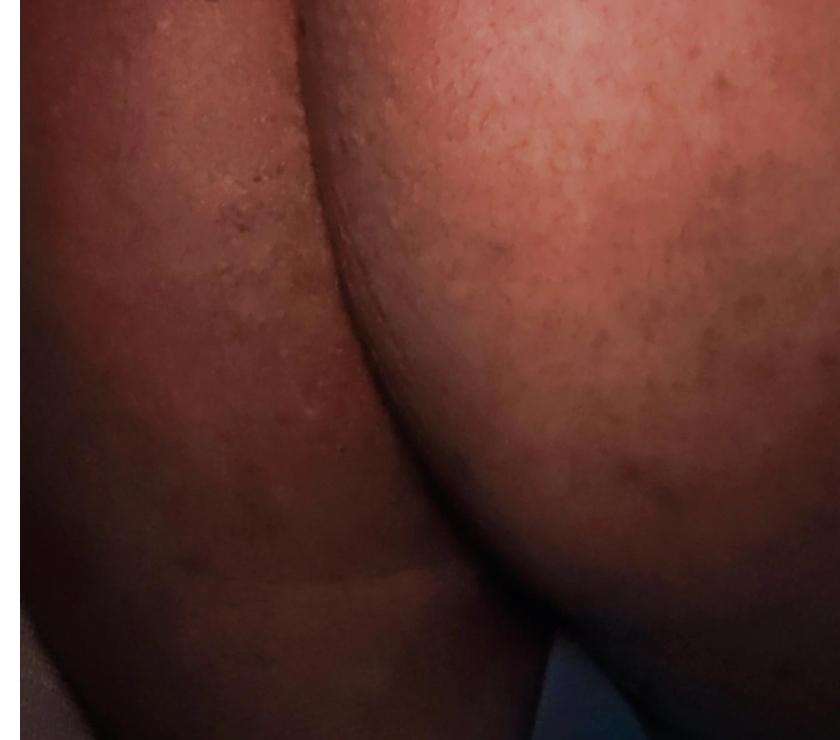 Encontros Casuais Caxias RJ - Fotos para Moreno quente s2