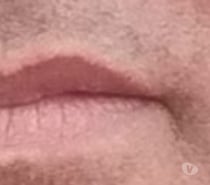 Casualidade e transparência