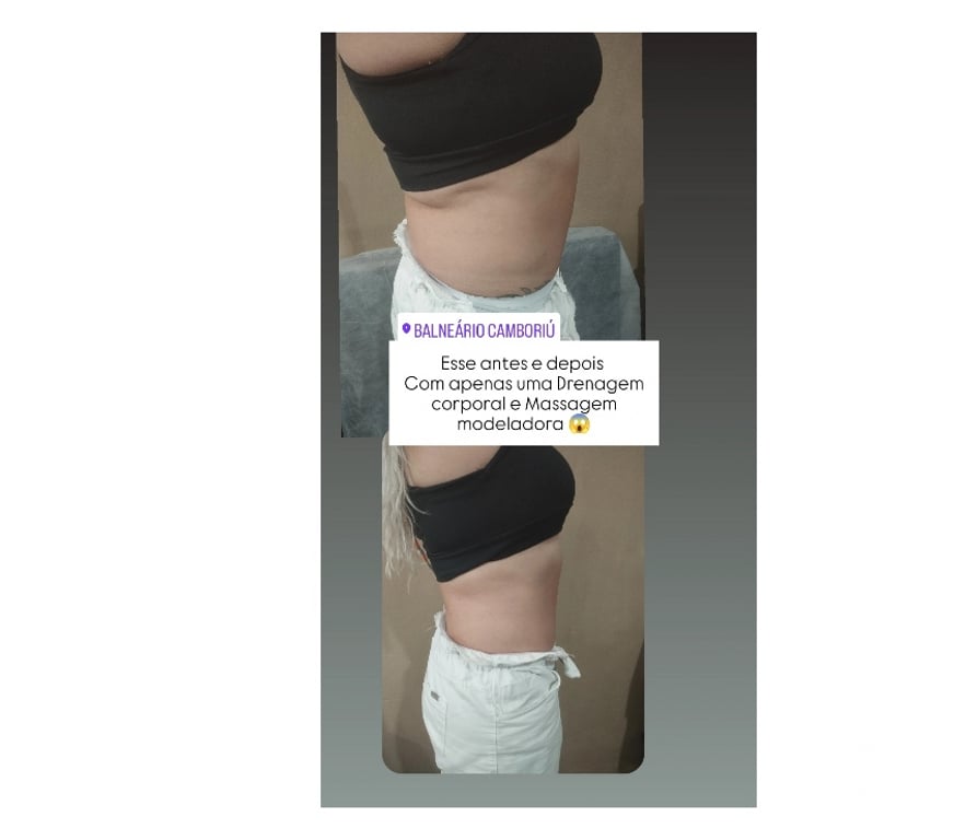 Bem-Estar - Saúde - Beleza Balneario Camboriu SC - Fotos para Massagem como medicina alternativa