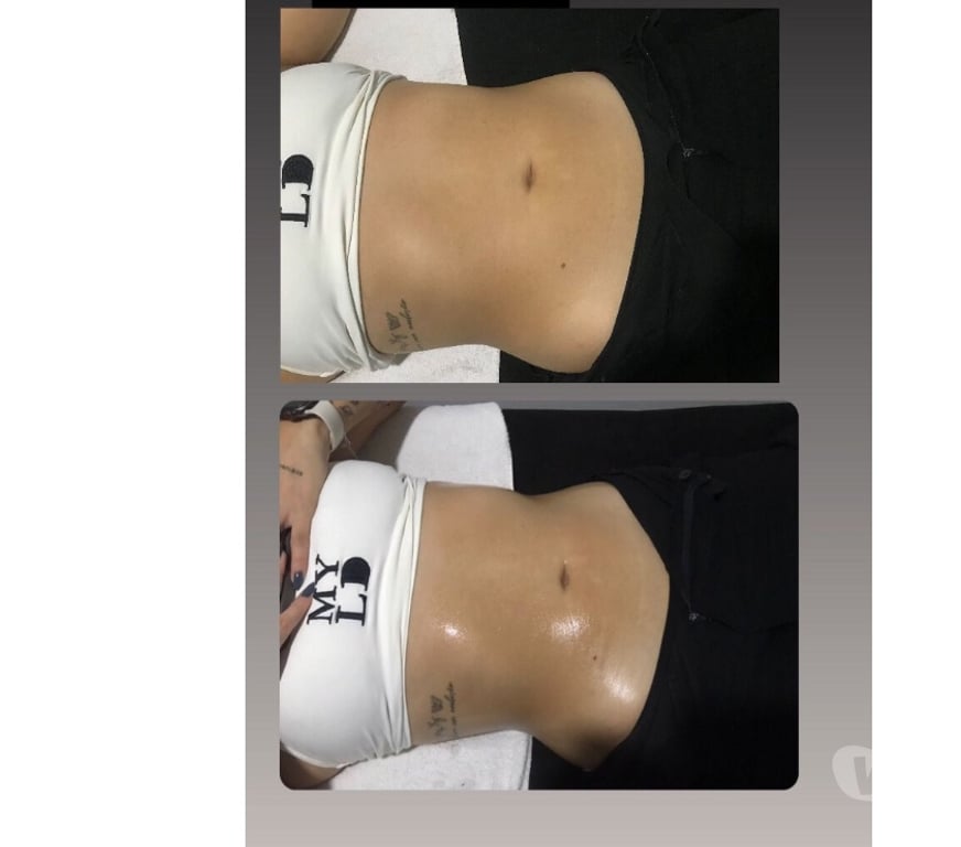 Bem-Estar - Saúde - Beleza Balneario Camboriu SC - Fotos para Massagem como medicina alternativa