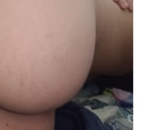 Bi Rabudo quer pikao Grosso C.LocalZsul