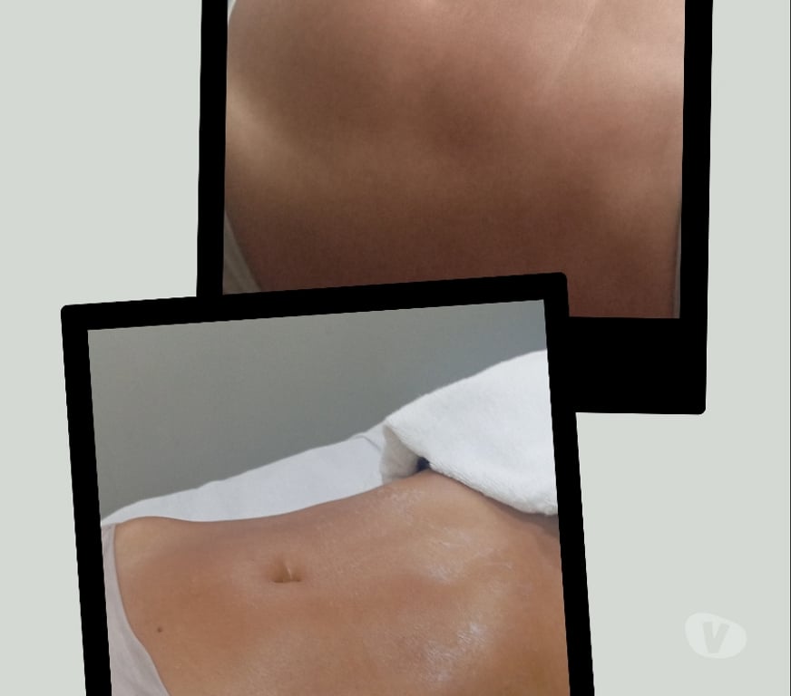 Bem-Estar - Saúde - Beleza Sao Paulo SP Outros Bairros Sao Paulo SP - Fotos para Massagem Relaxante e Drenagem Linfática