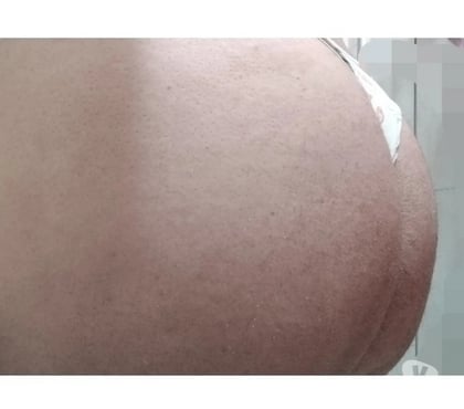 Encontros Sexuais - Fotos para Gordinho passivo, somente passivo