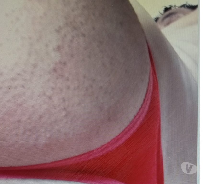 Encontros Casuais Porto Alegre RS Porto Alegre Norte - Fotos para QUERO SEXO casual FIXO COM ATIVO LIVRE