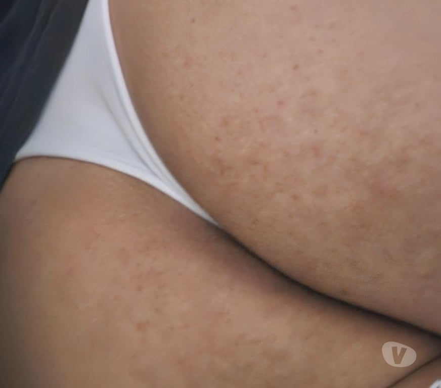 Encontros Casuais Belo Horizonte MG Oeste - Fotos para Cedezinha busca encontro com coroas