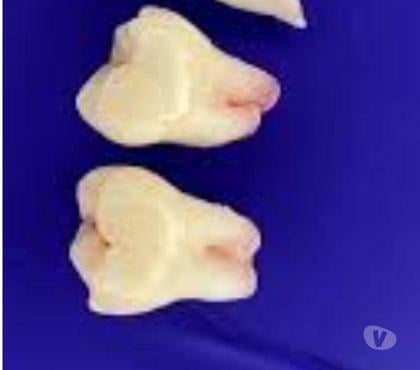 Varios Santiago Santiago - Fotos de Dientes practica preclinico