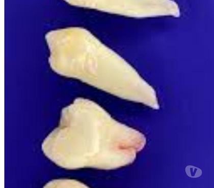 Varios Santiago Santiago - Fotos de Vendo dientes endodoncia