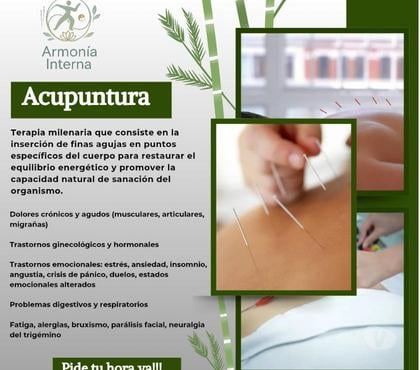 Bienestar Valparaíso Valparaíso - Fotos de Acupuntura y medicina china