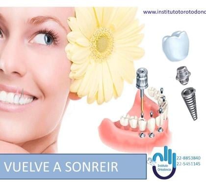 Bienestar - Masajes La Florida Santiago - Fotos de Vuelve a Sonreír- Implantes dentales a tu Alcance
