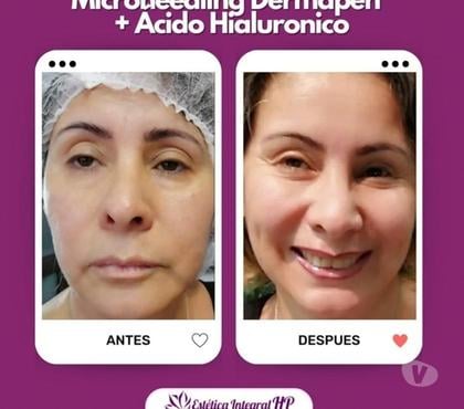Bienestar San Miguel Santiago - Fotos de Microblading Cejas pelo a pelo