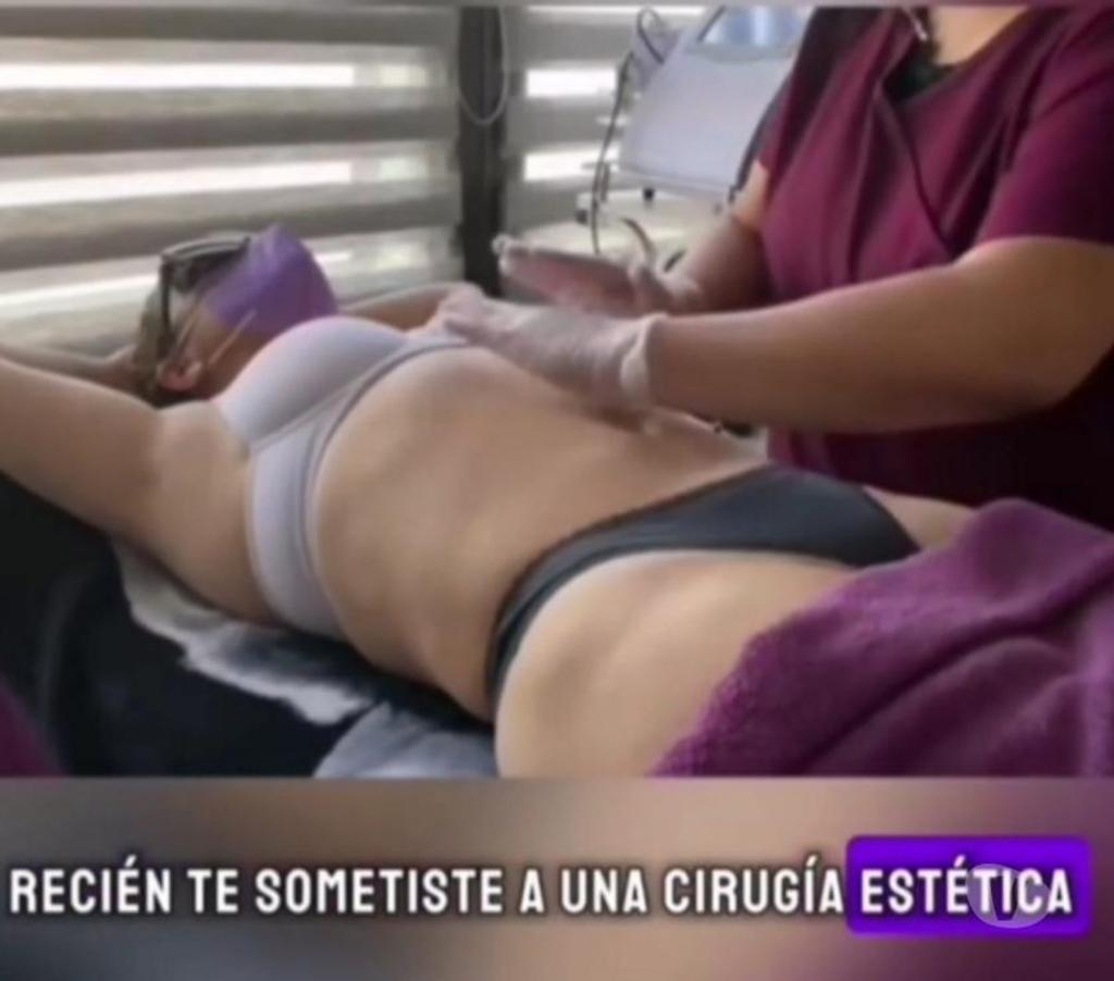 Masajes Santiago San Miguel - Fotos de Tratamiento Post Cirugía Estética