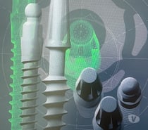 Fotos de IMPLANTES DENTALES